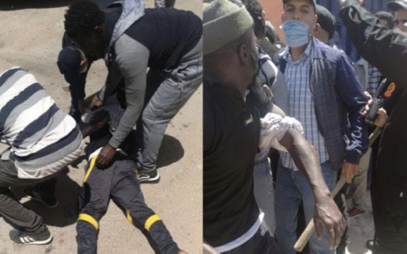 Violent Clash at Moroccan Migrant Center Leaves Officers Injured, One Migrant Shot